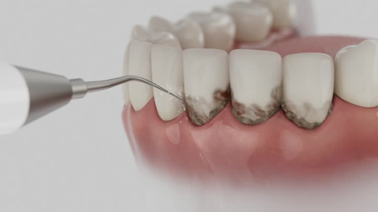 Reliable Dental Implants contractor in Burton, MI by Smile Center Dentistry